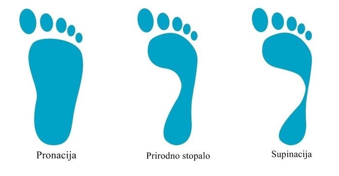 Oblik stopala - pronacija, prirodno stopalo, supinacija
