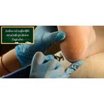 Tečaj medicinske pedikure - naučite pravilnu obradu nokta te otklanjanje boli...
