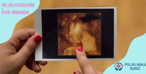 4D ultrazvuk i DVD snimka vaše bebe na drugačiji način pomoću kvalitetnog...