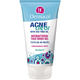 Dermacol AcneClear Antibacterial gel za problematičnu kožu 150 ml